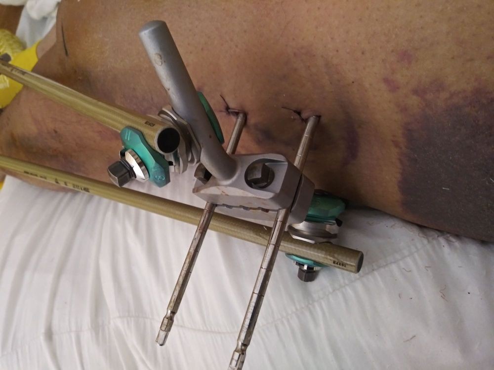 A close-up view of a metal tool or piece of industrial machinery with adjustable components.