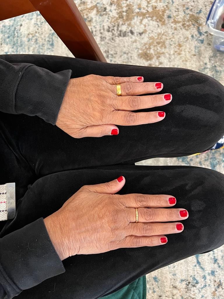 A pair of hands with red nail polish and a gold ring resting on black clothing.