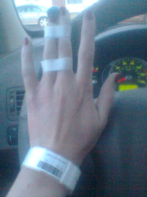 A bandaged hand with a hospital wristband holds a steering wheel.