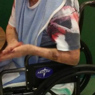 An elderly person sitting in a wheelchair, showing their hands.