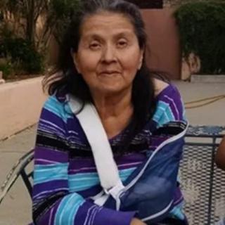 An elderly woman sitting outdoors on a chair, wearing a striped shirt and an arm sling.