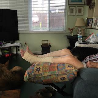A person relaxing at home with a leg cast, accompanied by a dog.