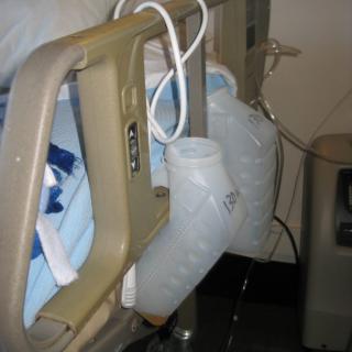 A hospital bed with a urinal bottle attached to the side rail, indicating patient care facilities.