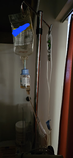 An intravenous (IV) setup used for administering medication or fluids.