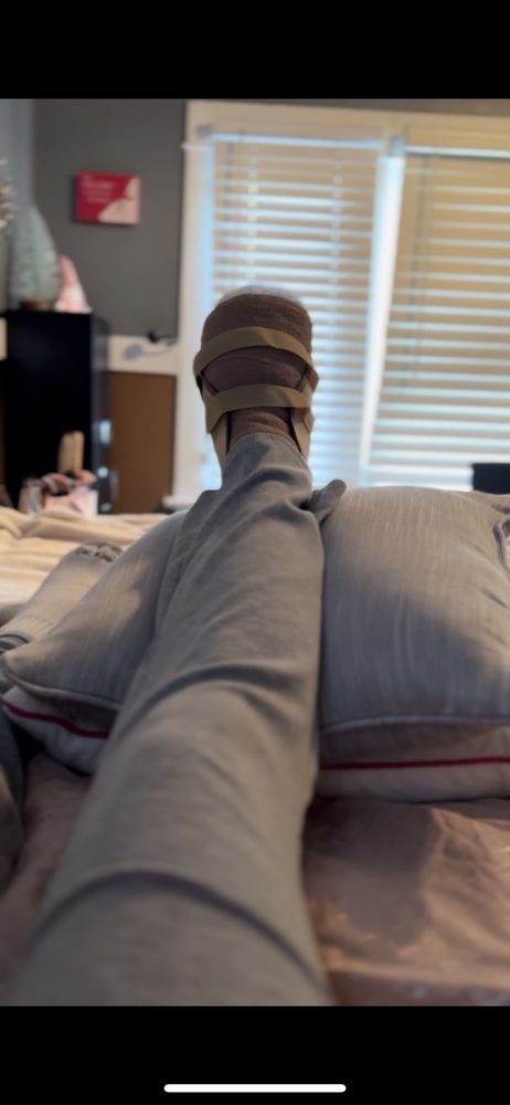 A leg in a cast resting on pillows indoors.