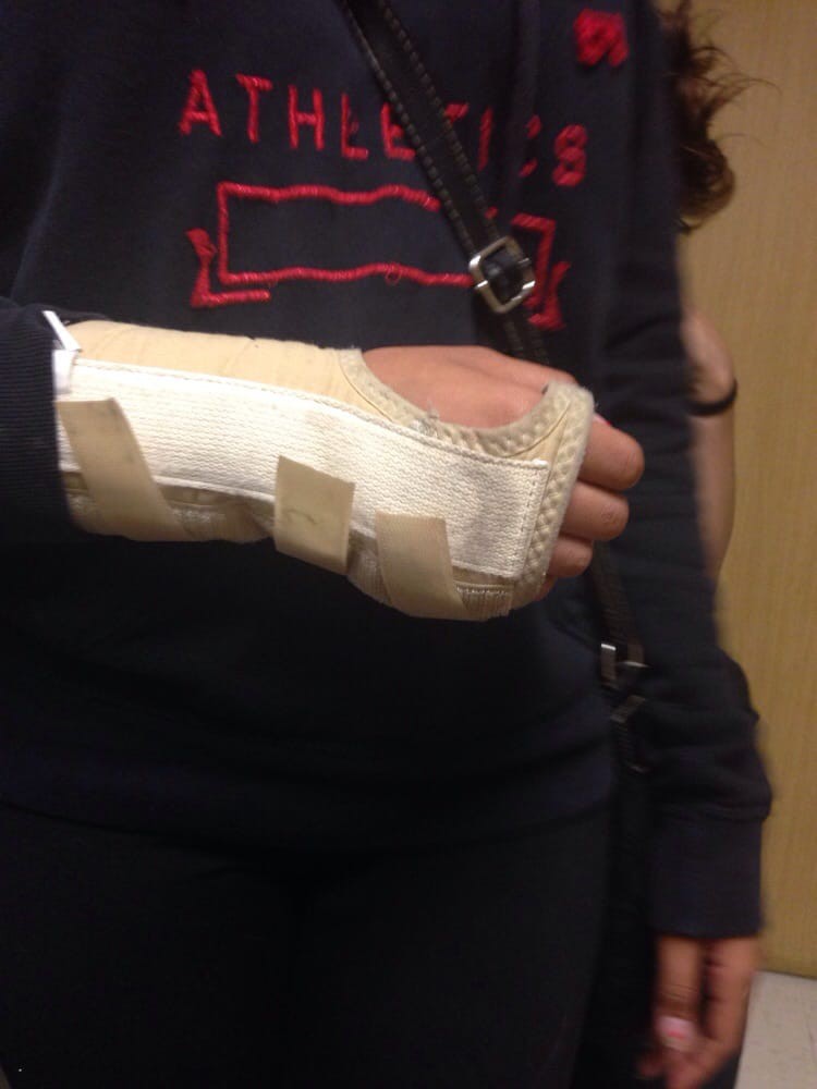 A person wearing a cast on their arm, indicating an injury.