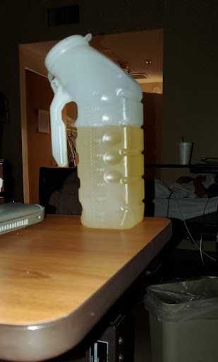 A container filled with a yellowish liquid placed on a table.
