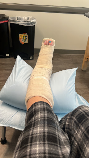 A leg in a cast resting on pillows, indicating recovery from an injury.
