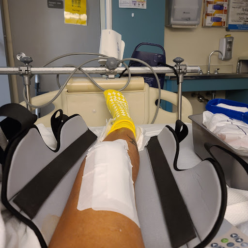 A leg with a bandage resting in a hospital setting, indicating post-treatment care.