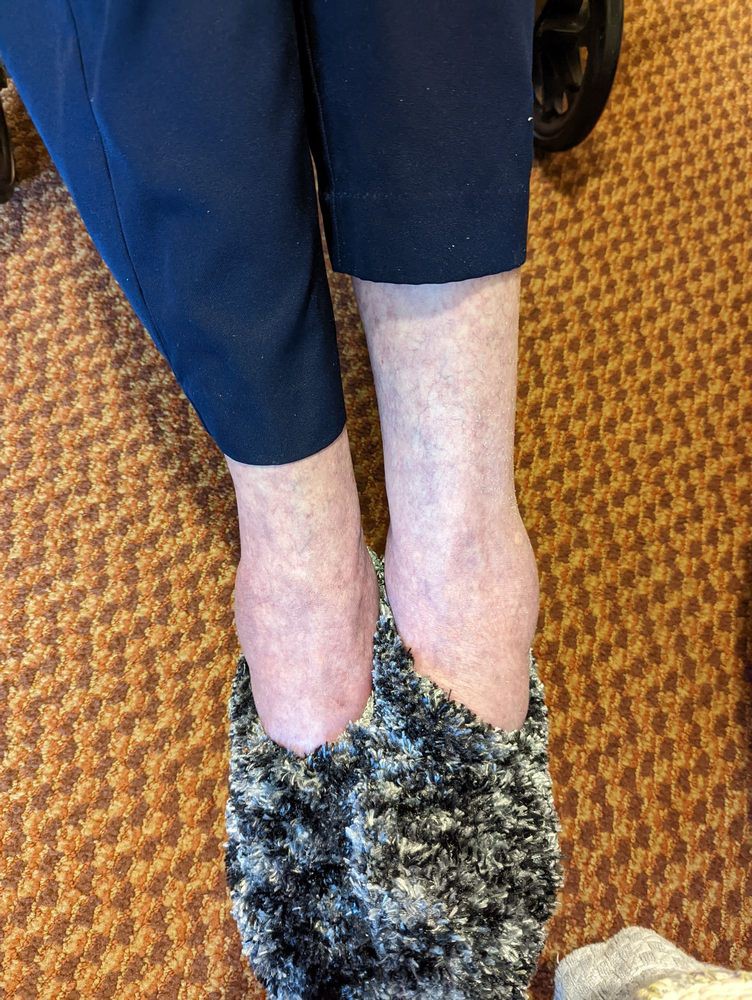 A pair of feet in patterned slippers on a carpeted floor.