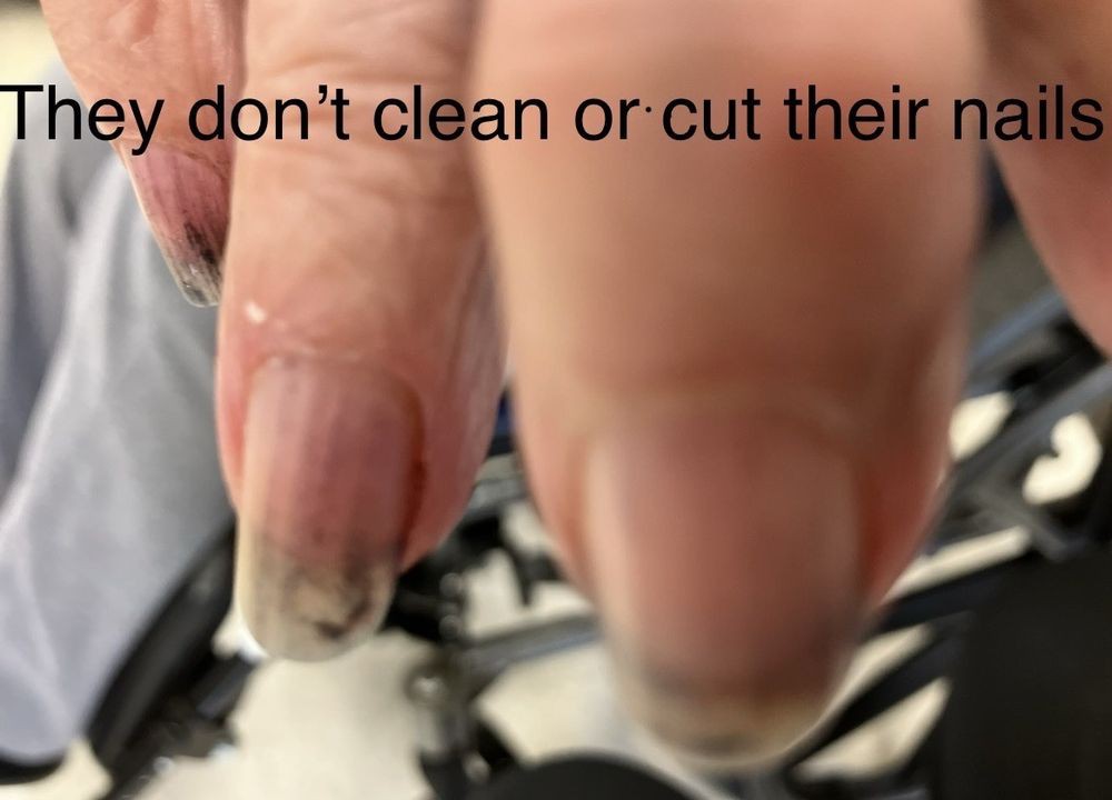 Close-up of fingers with unclean and long nails.