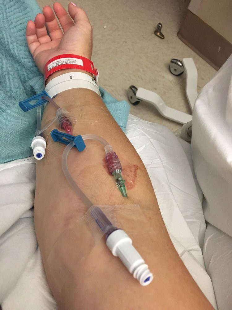A patient's arm with tattoos and intravenous lines in a hospital setting.